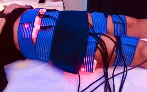 trattamento lipolaser